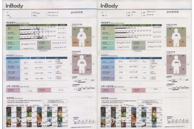 운동없이다이어트