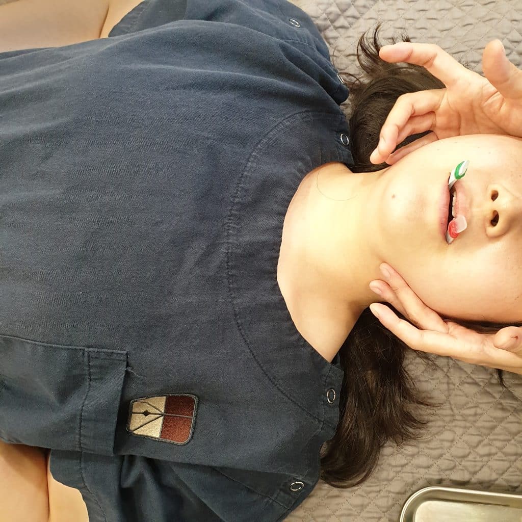 구강작열감증후군 원인