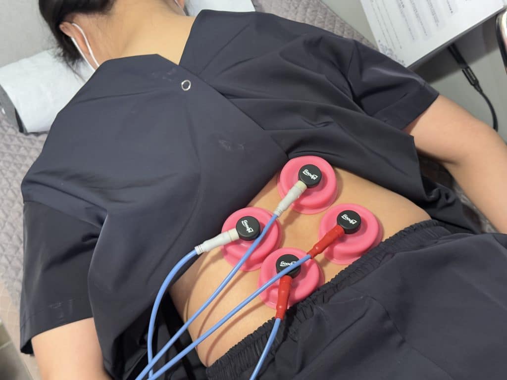 음부신경 포착증후군